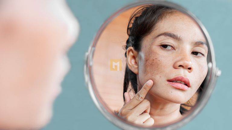 7 Doctor-Approved Ways to Get Rid of Hyperpigmentation