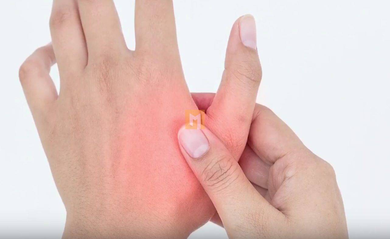 What to know about thumb arthritis