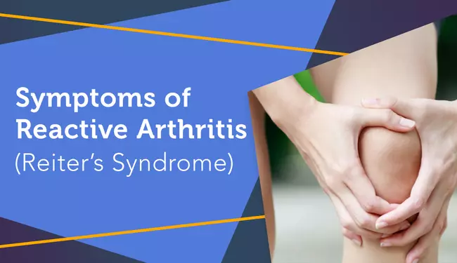 Reactive arthritis: What you should know