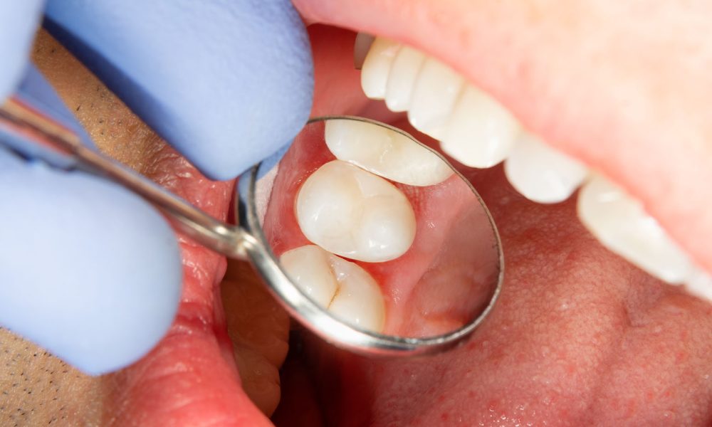 15 Common Tooth Problems and How to Solve Them