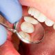 15 Common Tooth Problems and How to Solve Them